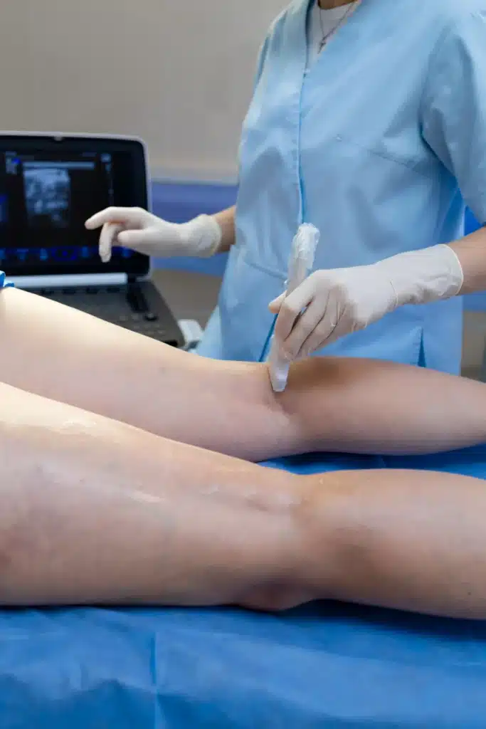 A doctor at Espada Vascular in Texas treats Leg Ulcers